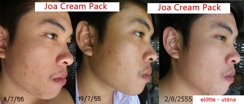 arcmaszk JOA arcmaszk