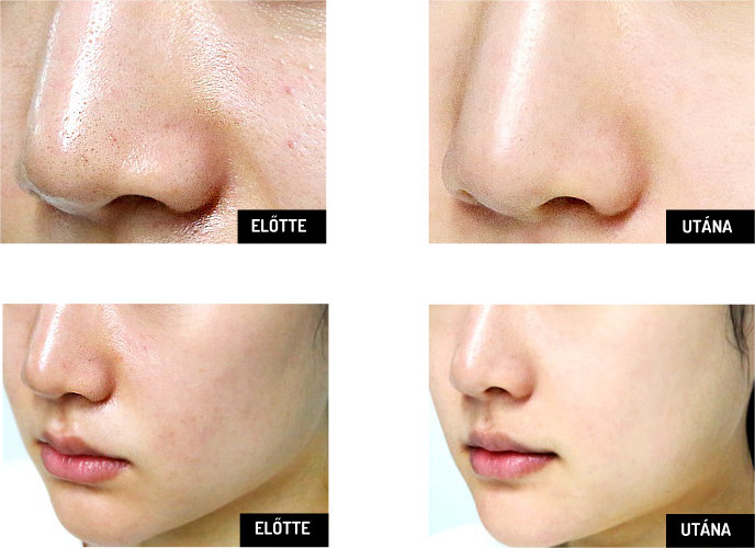 So Natural fekete maszk eredménye So Natural fekete maszk eredménye